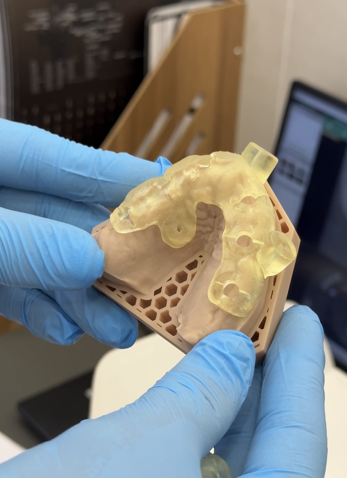 3D печать хирургических шаблонов